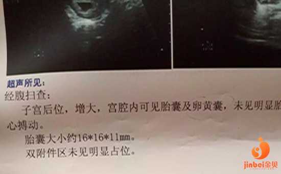 南京如何看待代孕合法化,【南京试管供卵机构供卵对人体有伤害吗】孕周33周