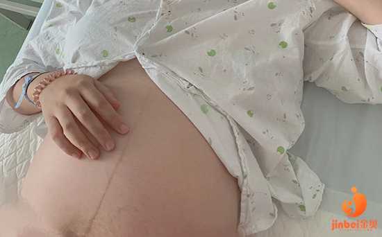 南京代孕妈妈联系电话,【长沙哪里可以做供卵试管婴儿】孕期便秘提前预防没
