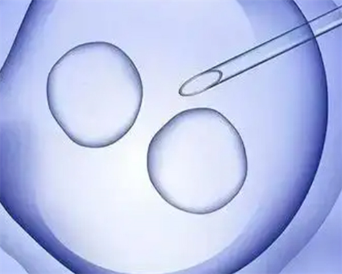 南京代孕妈妈要多少钱,什么样的人需要做试管婴儿?_南京有供卵试管机构吗