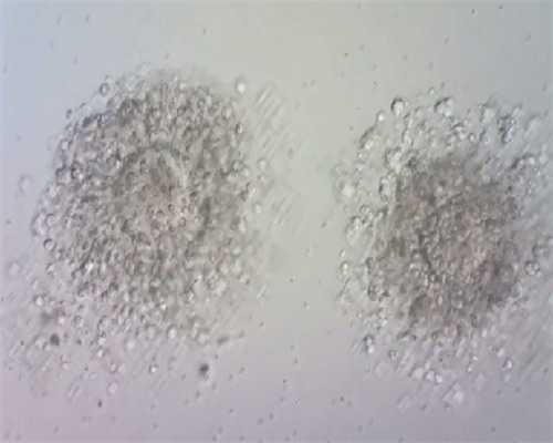 南京做试管代孕哪家好,尽量不要做二代试管？了解它的优势！_有移植后情绪不