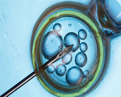 南京那家供卵机构比较好 南京做羊水穿刺费用一览 ‘32周双顶径看男女’