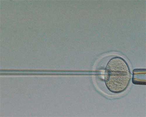 南京代孕网靠谱吗,南京试管双胎龙凤胎多还是同性多_正规试管助孕机构-试管婴