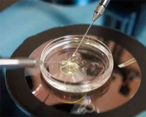 钟丽缇为备孕的经历与心得分享