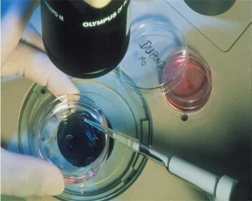 南京借卵供卵试管生子的条件 南京市妇幼保健院 ‘孕妇三维彩超看男女’