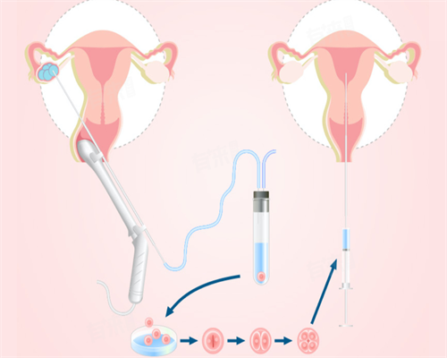 南京有谁知道代怀中介,2026北京大学第三医院做三代试管供卵费用清单_南京有供