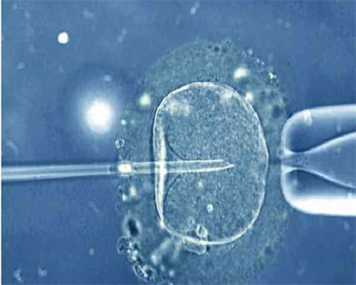 南京代生交流群,试管婴儿有弊端吗_上海有没有供卵机构-南京供卵试管成功率高