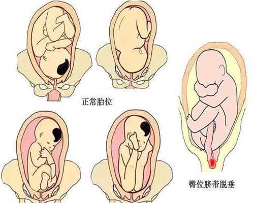 南京代孕哪里靠谱_南京试管借卵多少钱一次_中国正规规孕机构_珠海靠谱的代怀